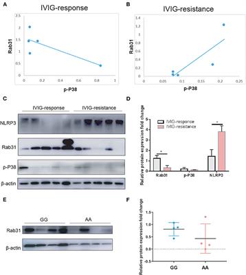 Association between Rab31/rs9965664 polymorphism and immunoglobulin therapy resistance in patients with Kawasaki disease